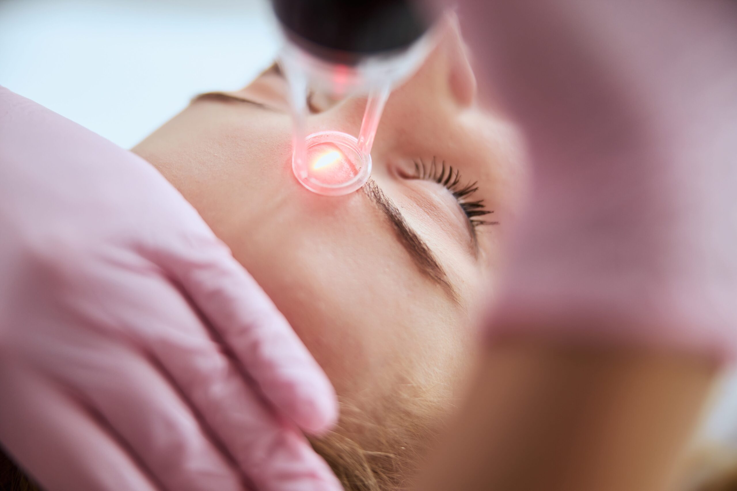 A close-up of a Laser Genesis session where a laser device targets facial skin to improve texture and tone.