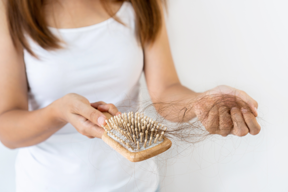 Woman holding a hairbrush full of hair loss before hair restoration.